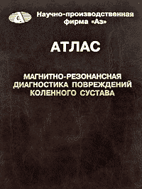Атлас Магнитно-резонансная диагностика повреждений коленного сустава. 