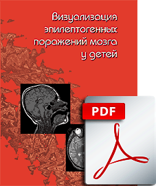 FILE: Визуализация эпилептогенных поражений мозга у детей. 