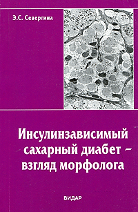 Инсулинзависимый сахарный диабет